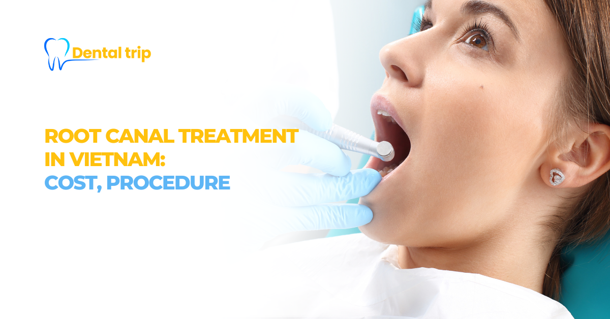 Root Canal Treatment in Vietnam