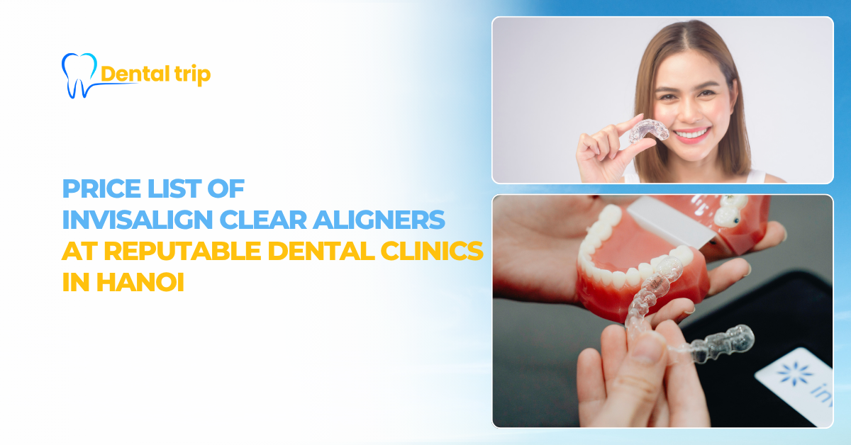 Price list of Invisalign clear aligners at 6 prestigious dental clinic in Hanoi