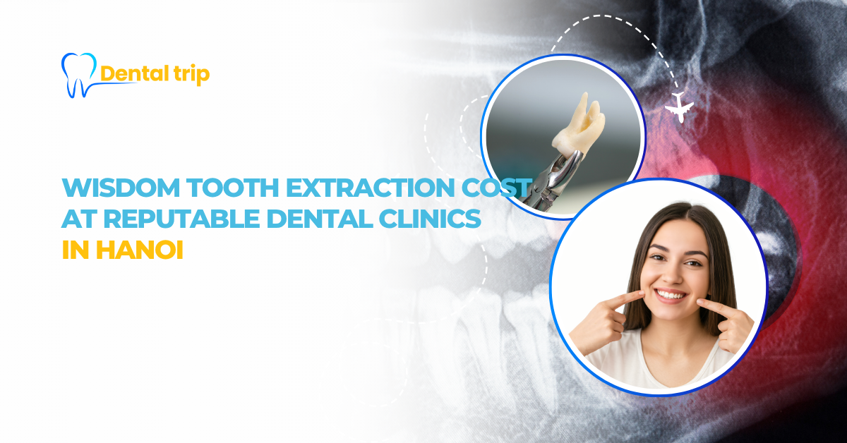 Wisdom tooth extraction cost at 6 prestigious dental clinics in Hanoi 
