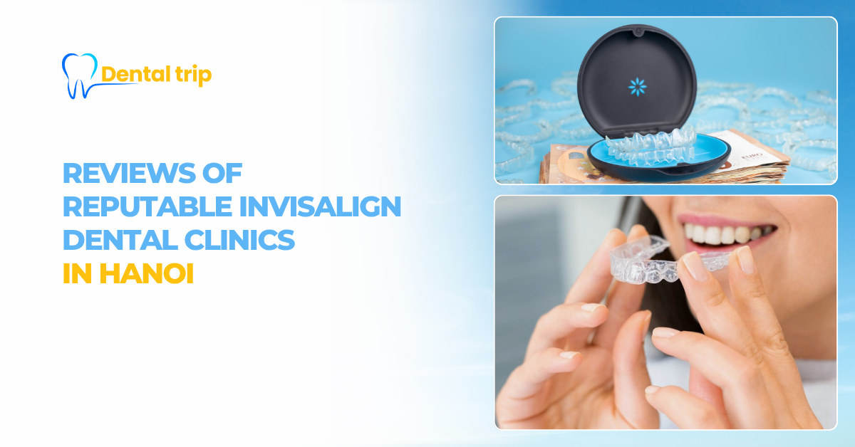 Trusted Invisalign clinics in Hanoi: Clear aligner review