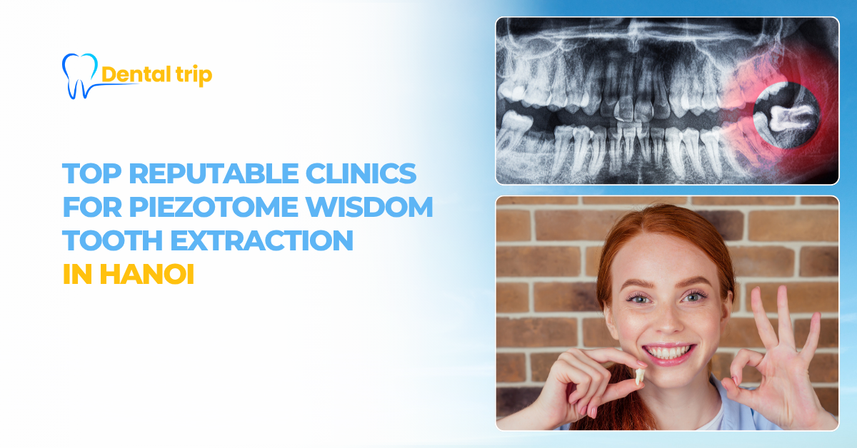 addresses for wisdom tooth extraction with Piezotome in Hanoi