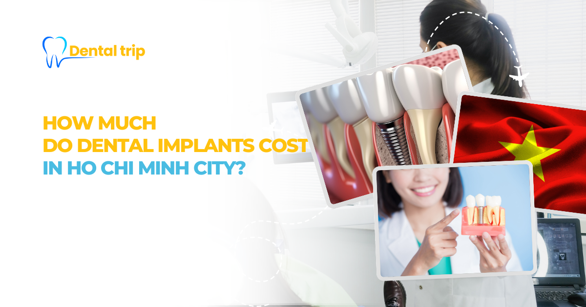 Dental implant cost in Ho Chi Minh City (2026 guide): Prices & Top dental clinics
