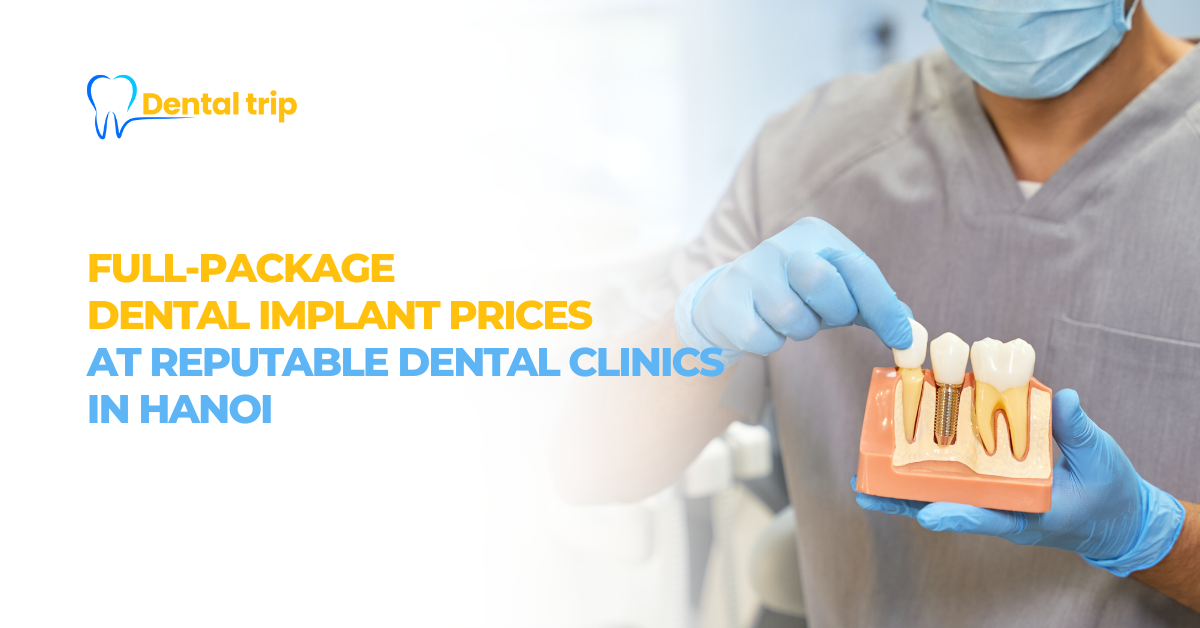 All-inclusive dental implant prices in Hanoi 2026: 5 reputable clinics