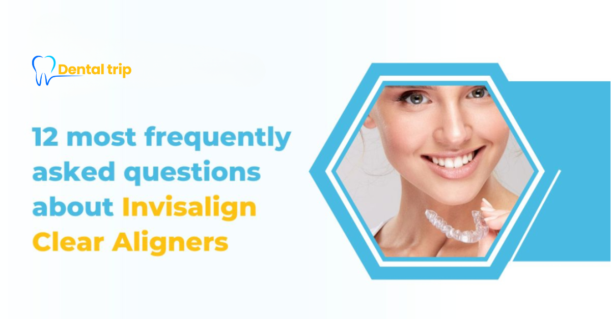 Invisalign Clear Aligners: 12 Most Frequently Asked Questions