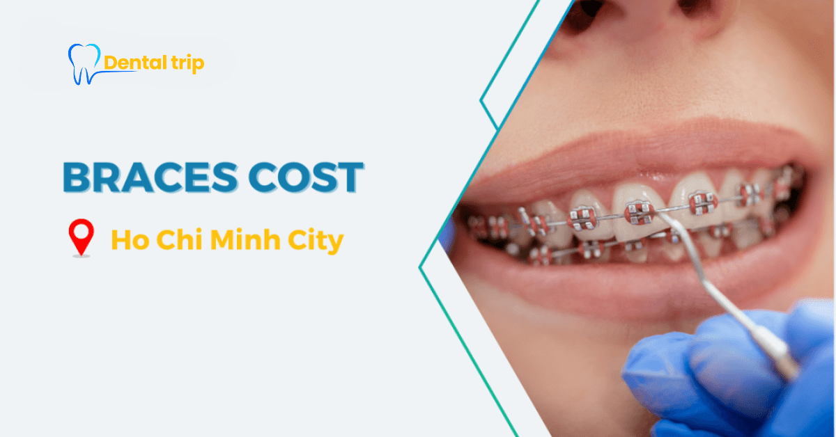 How much do braces cost in Ho Chi Minh City?