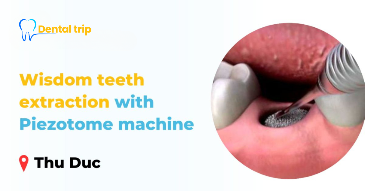 reputable wisdom teeth extraction with Piezotome machine addresses in Thu Duc