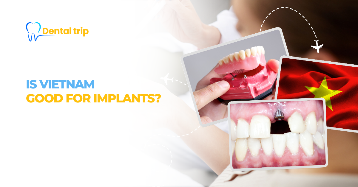 Is Vietnam good for implants?