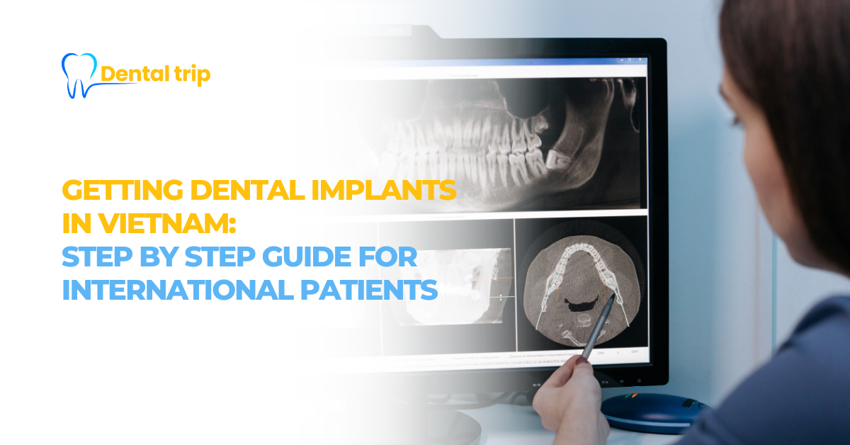 Getting dental implants in Vietnam: Step by step guide for international patients
