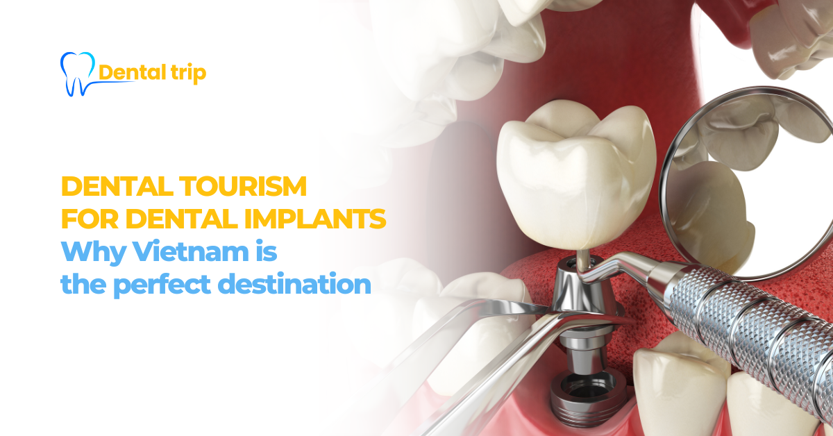 Dental tourism for dental Implants: Why Vietnam is the perfect destination