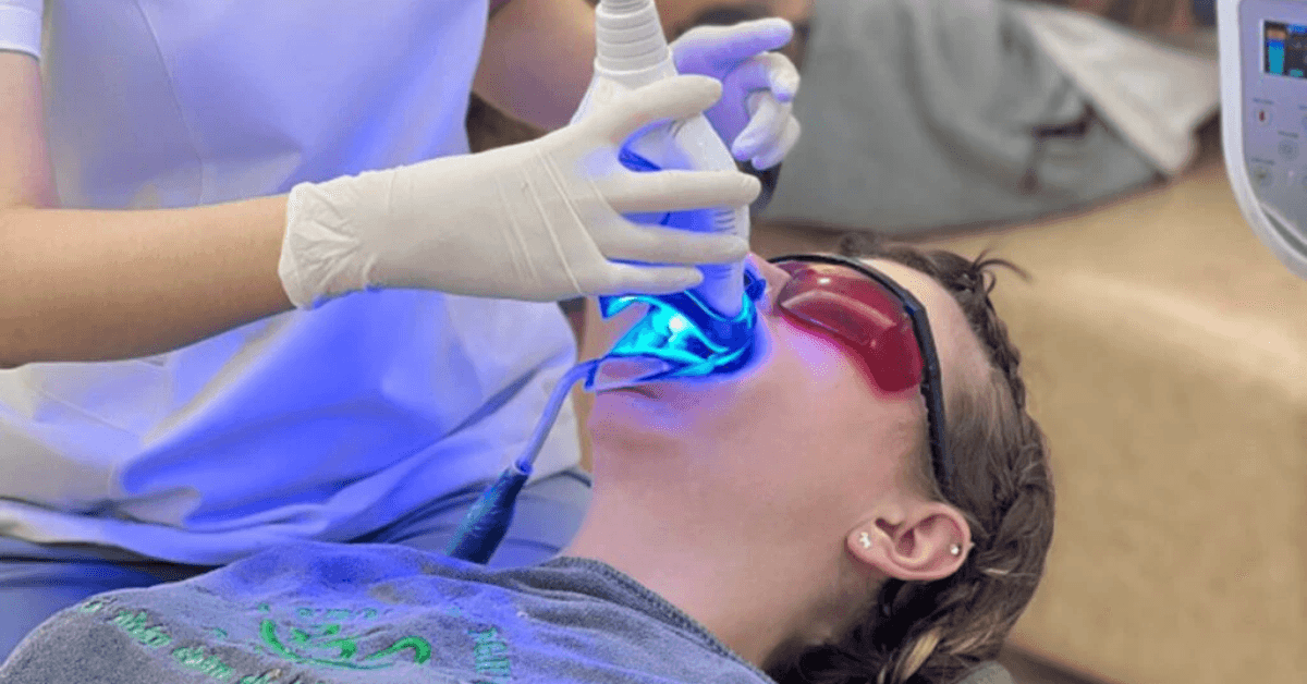Teeth whitening 365 Dental Clinic