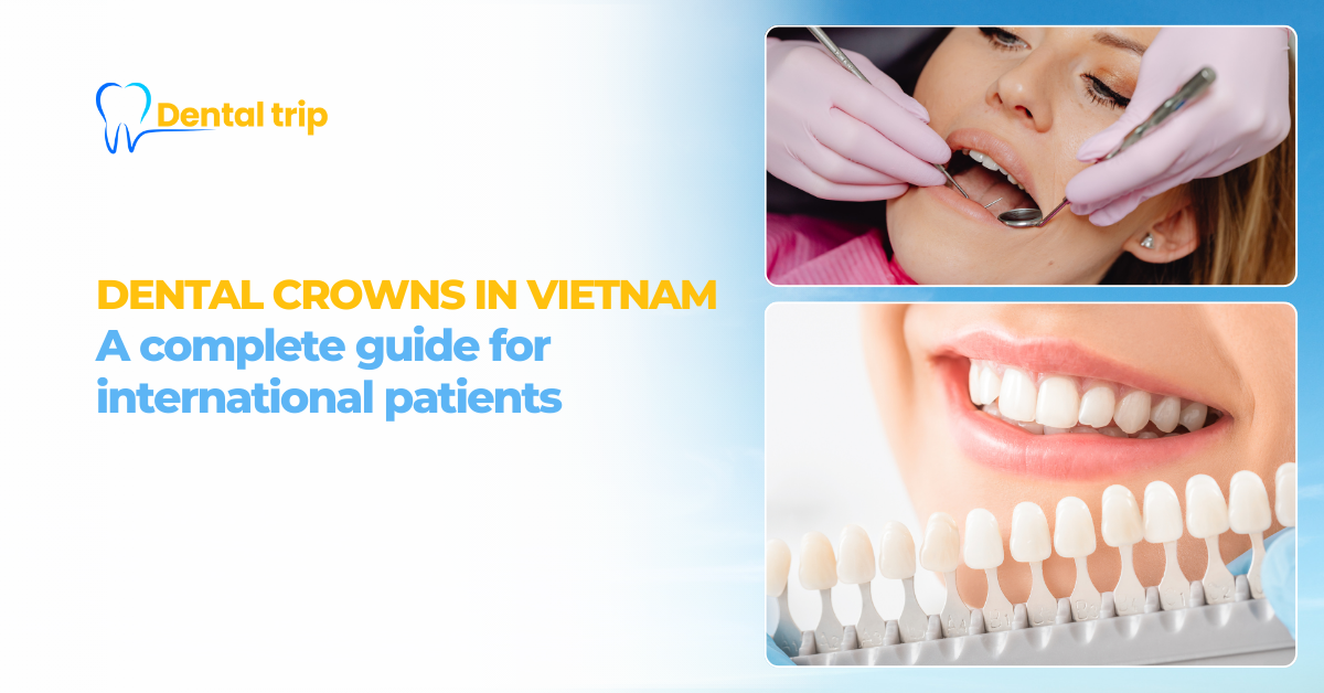 Dental crowns in Vietnam