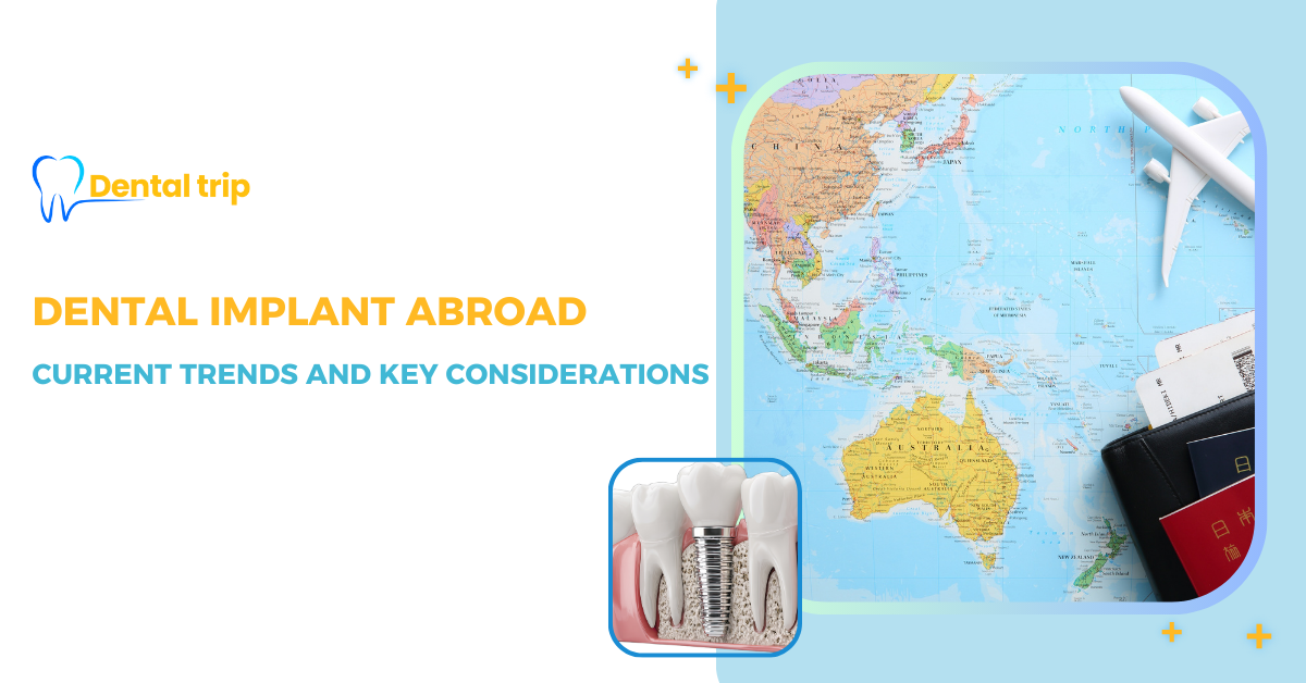 Dental implants abroad: Advantages, tips, and top countries