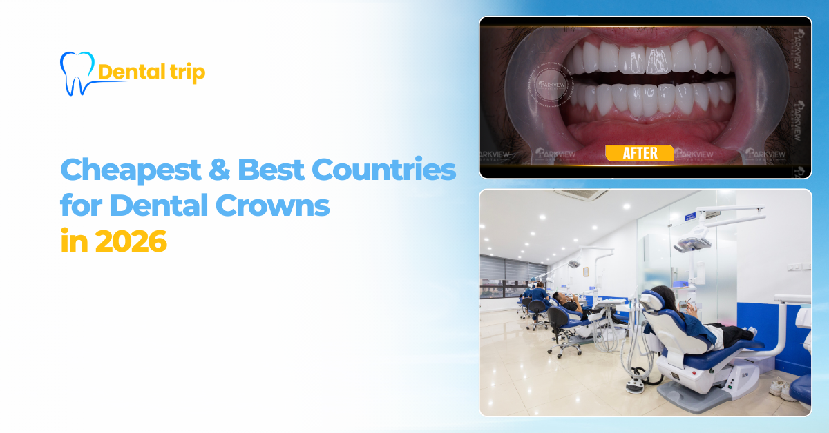 Which are the cheapest and best countries for dental crowns?