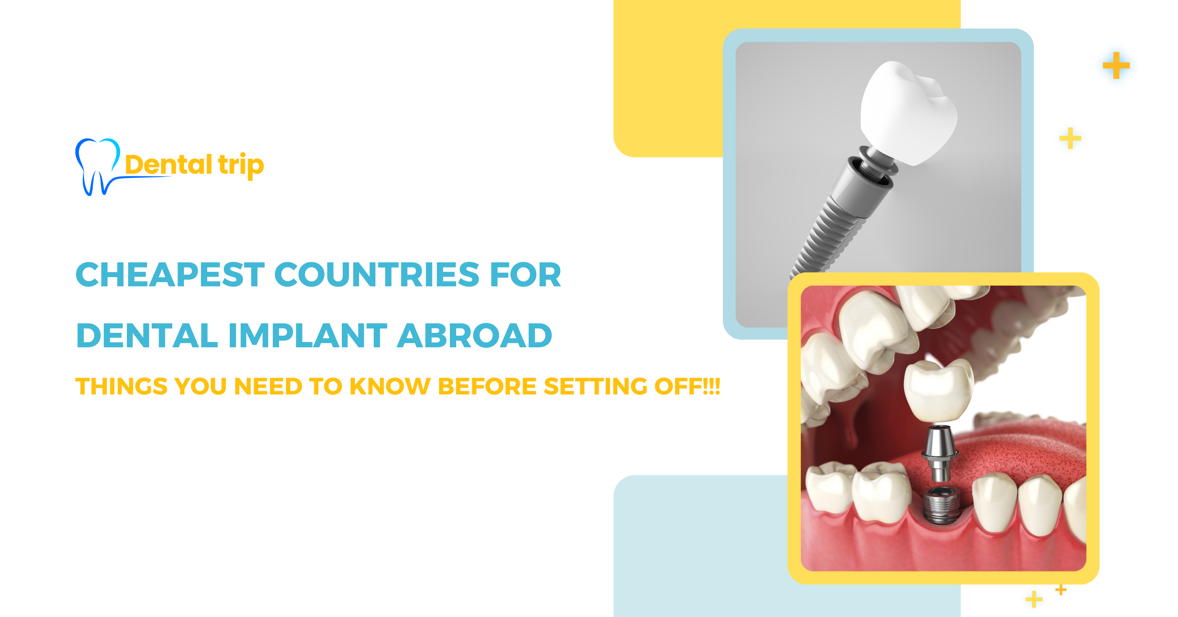 Cheapest countries for dental implants in 2026 