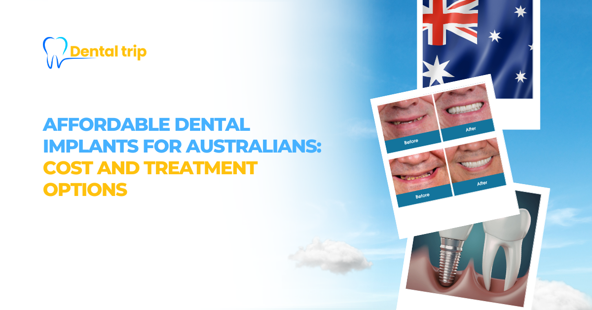 Affordable dental implants for Australia