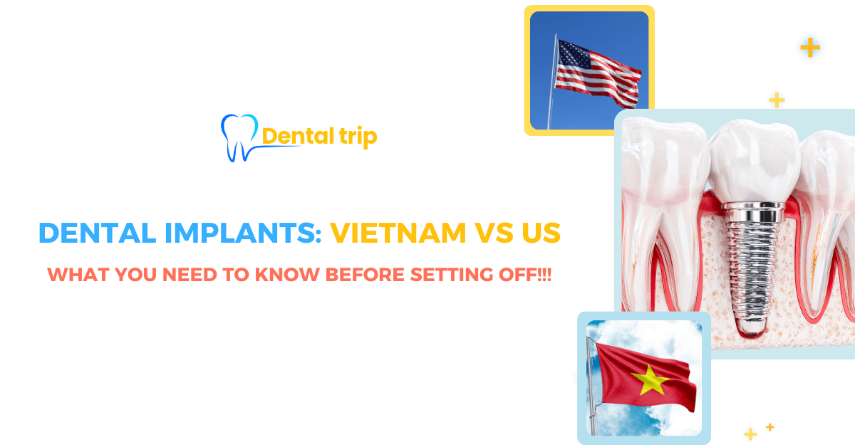 Is it worth traveling to Vietnam for dental implants?