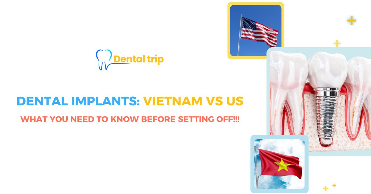 Is it worth traveling to Vietnam for dental implants?