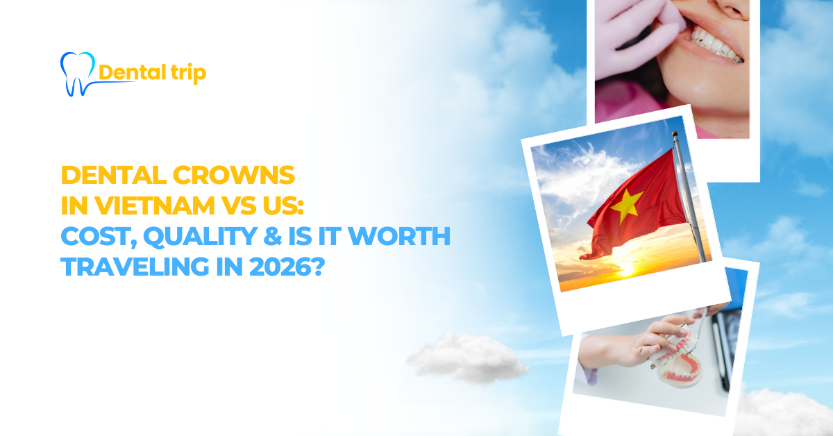 Dental Crowns Vietnam vs US