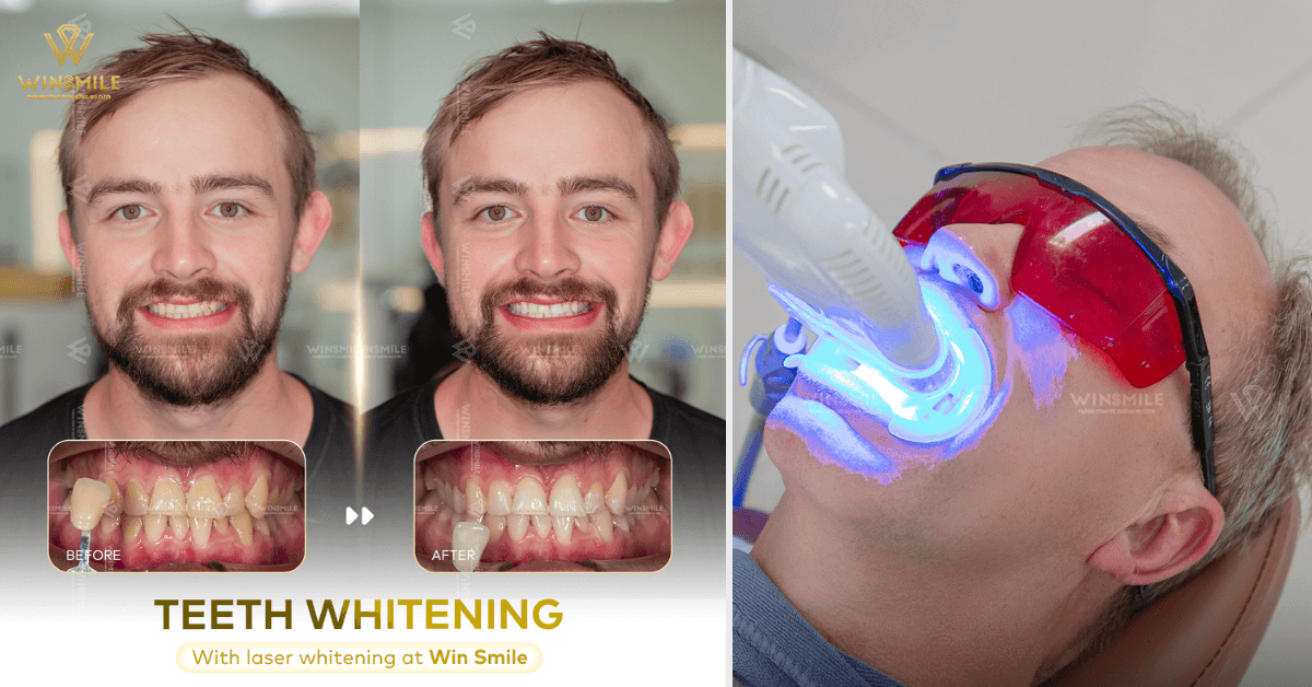 Win Smile Dental Clinic attracts many foreign patients for teeth whitening