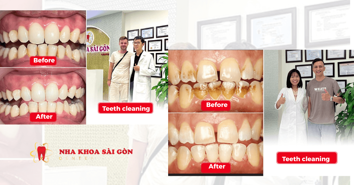 Sai Gon Center Dental Clinic