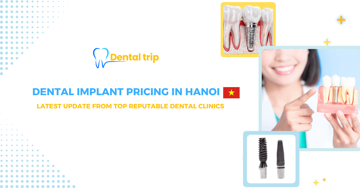Dental implant cost in Hanoi 2026: Latest prices, Brands & Trusted clinics