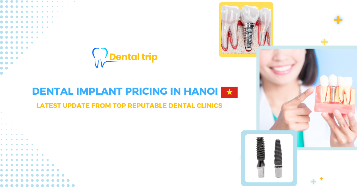 Dental implant cost in Hanoi 2026: Latest prices, Brands & Top clinics