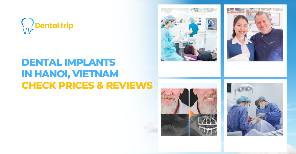 Top 7 clinics for dental implants in Hanoi (2026 updated guide)
