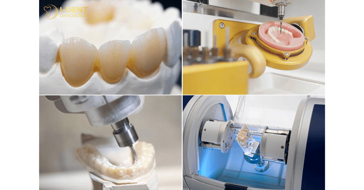 Dental crowns are crafted using advanced CAD/CAM technology
