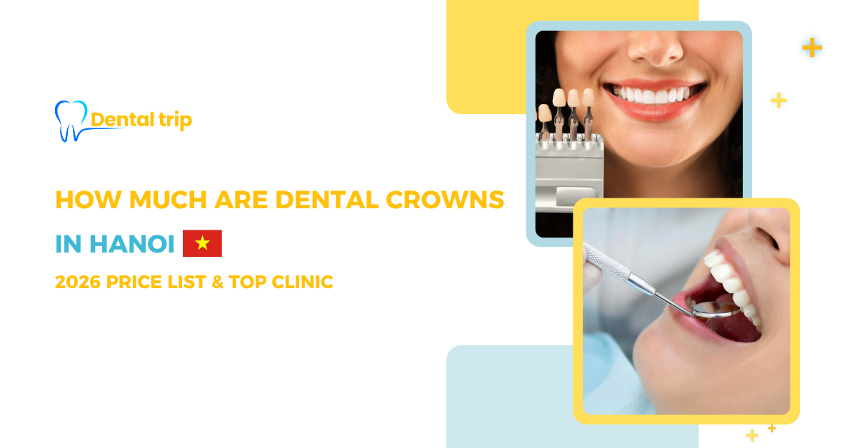 How much are dental crowns in Hanoi? 
