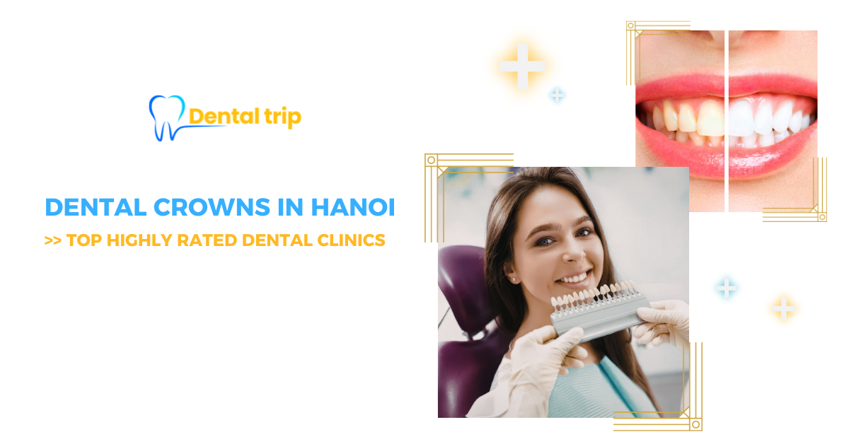 Top-rated dental crown services in Hanoi