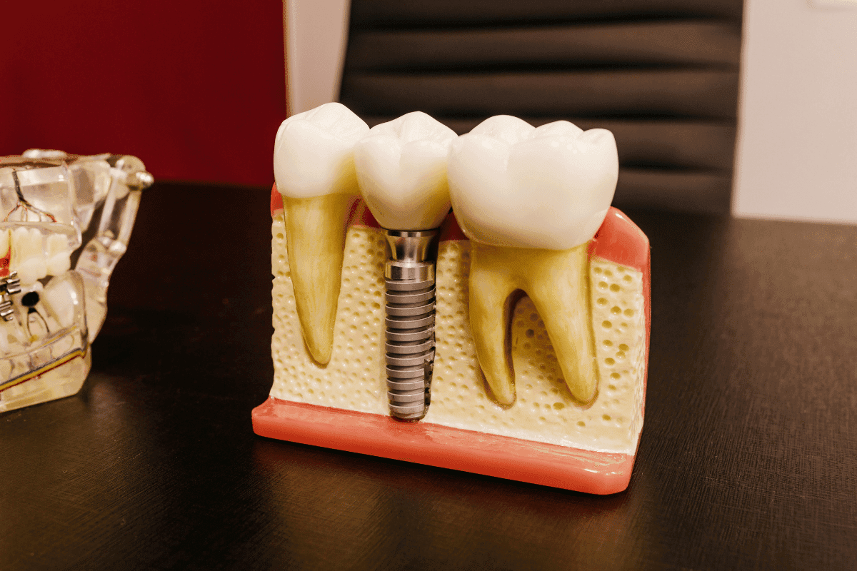 Dental tourism package