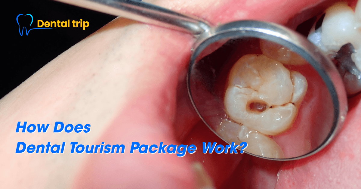 How Does a Dental Tourism Package Work?