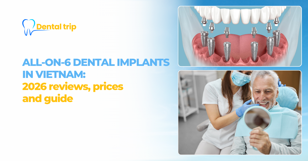 All-on-6 dental implants in Vietnam