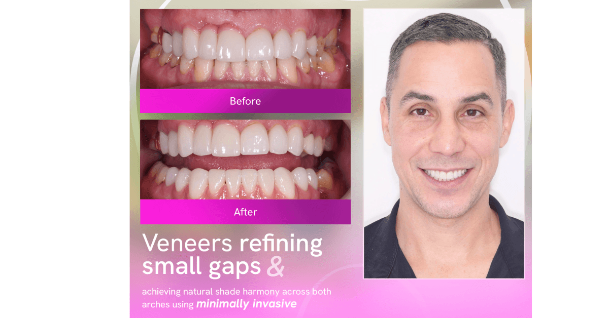 Dental  Tourism in Vietnam reviews
