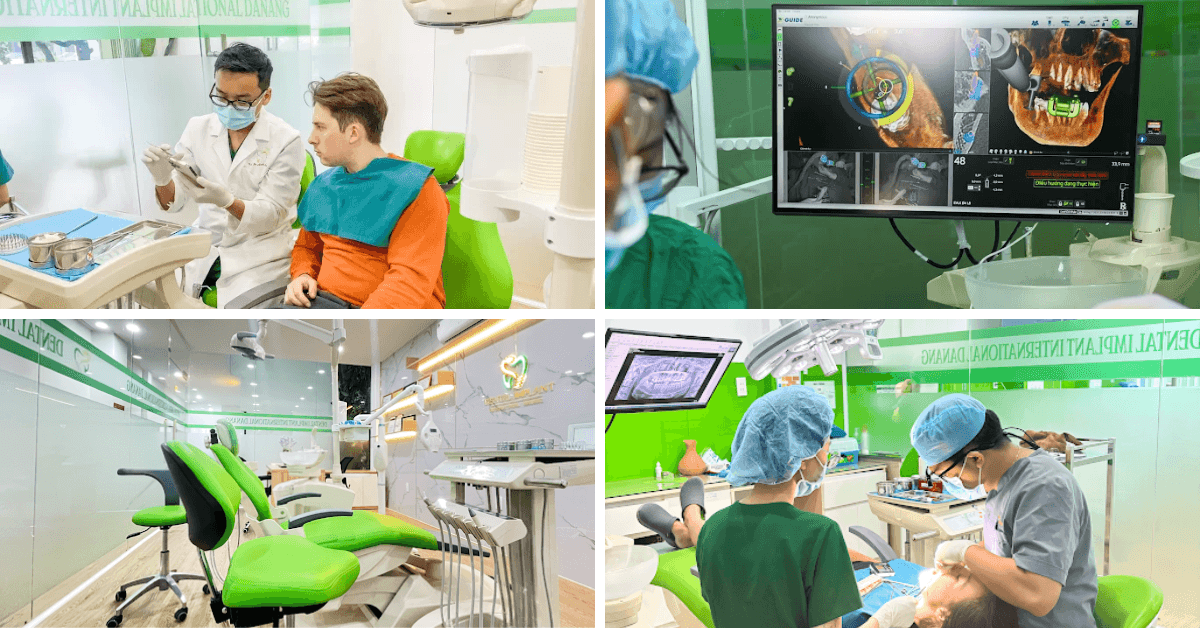 Da Nang Implant Dental Clinic