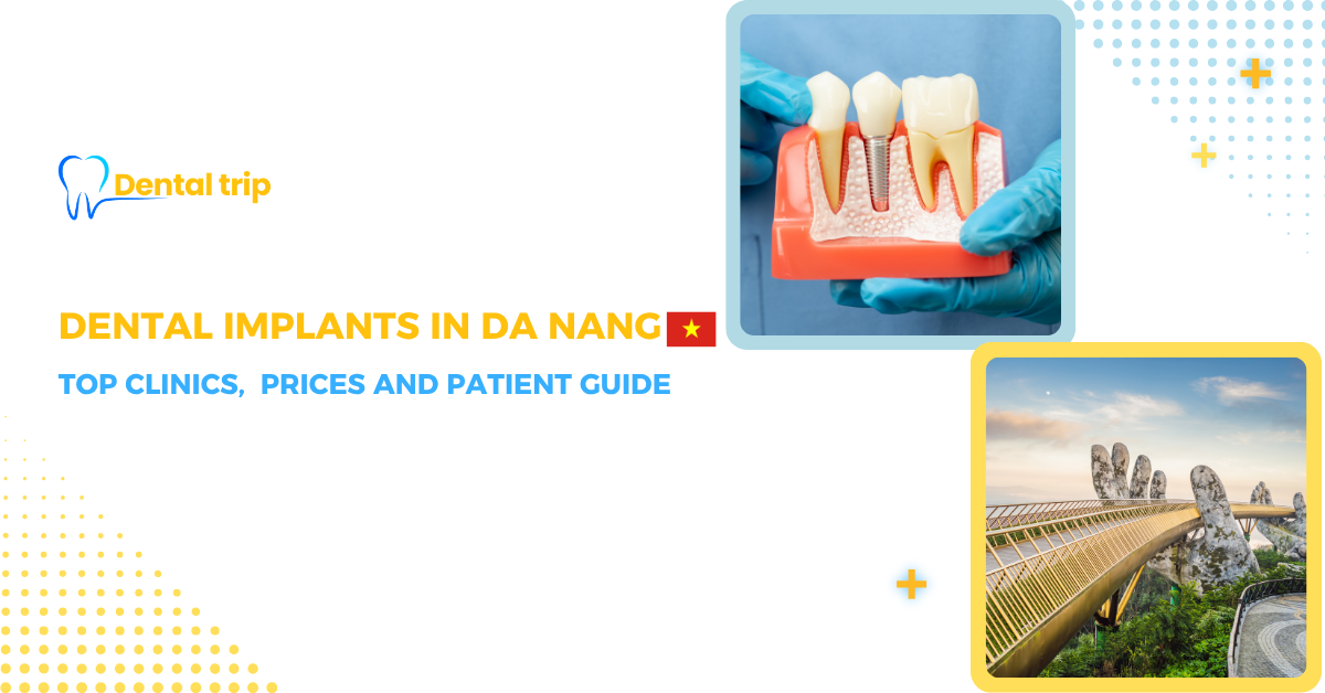 Dental Implants in Da Nang