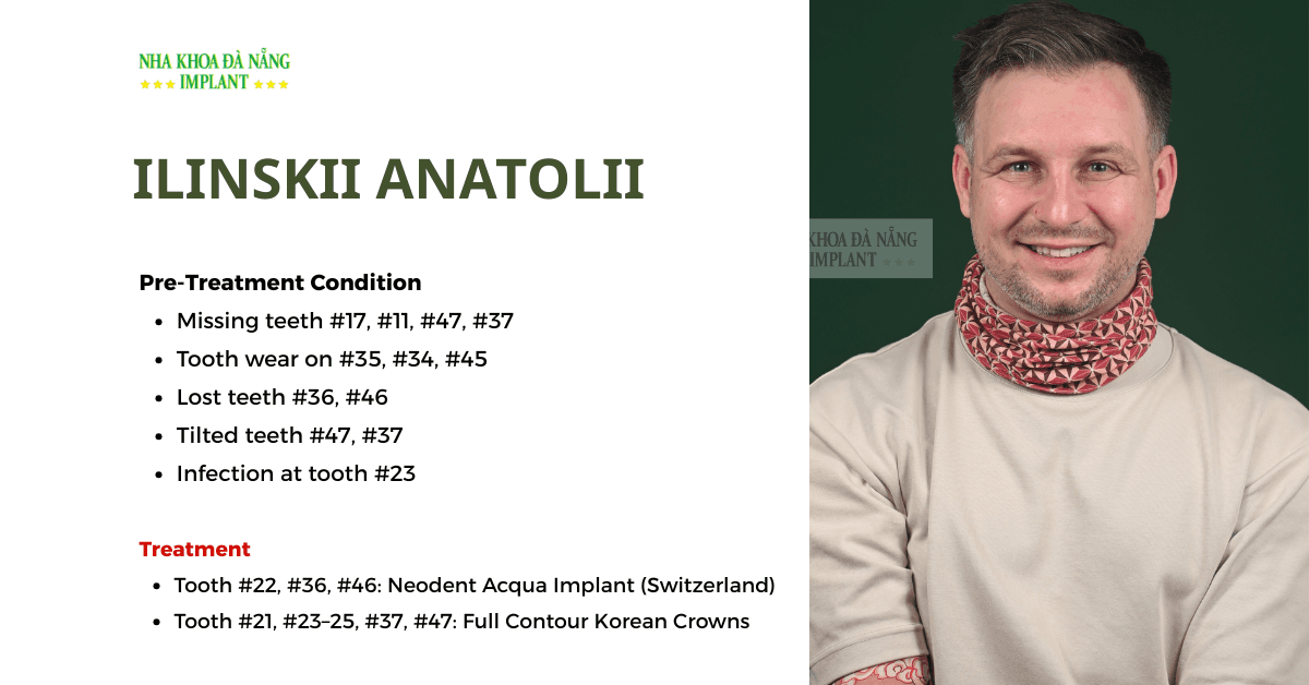 Dental  implants in Da Nang