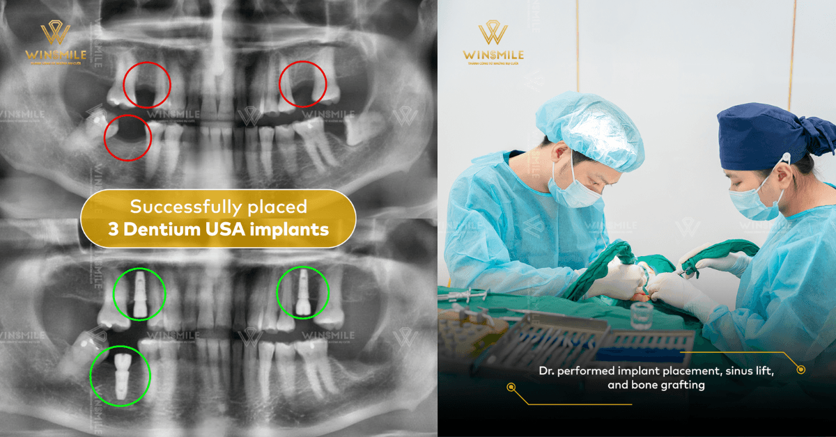 Win Smile Dental Clinic