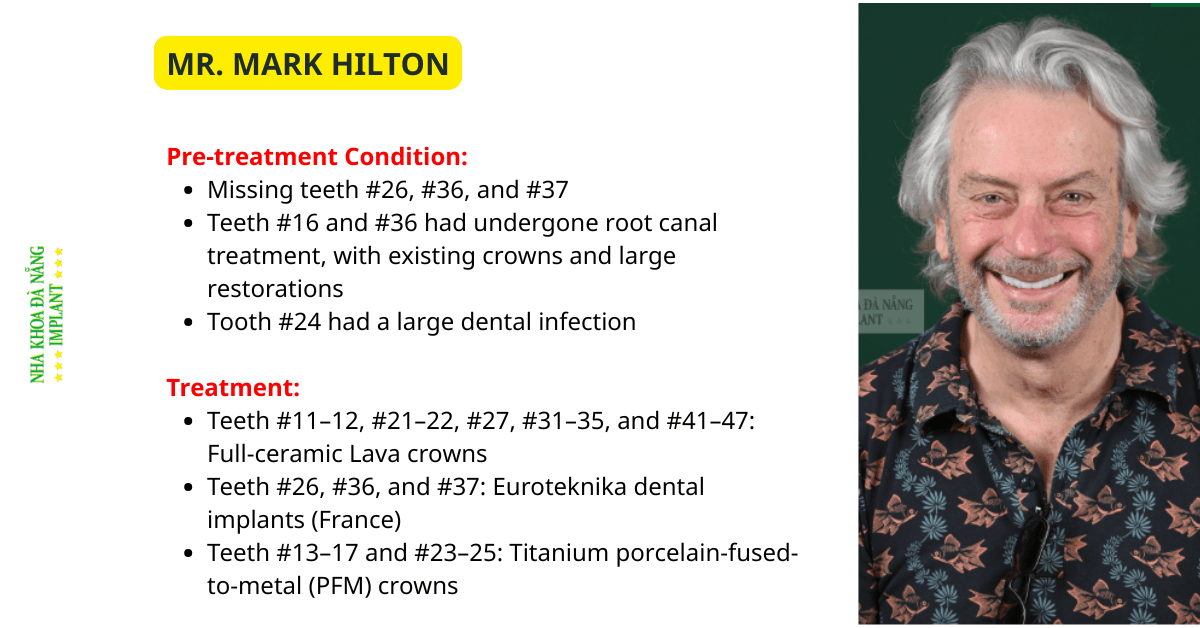 Dental Crowns in Da Nang