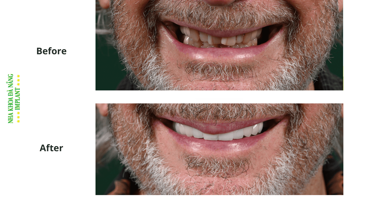 Da Nang Implant Dental Clinic