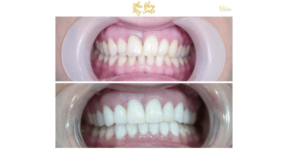 My Smile Dental Clinic