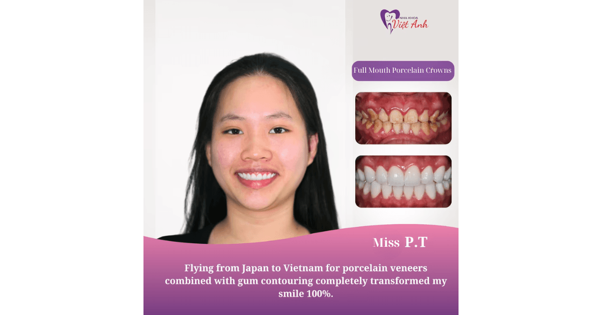 Viet Anh Dental Clinic