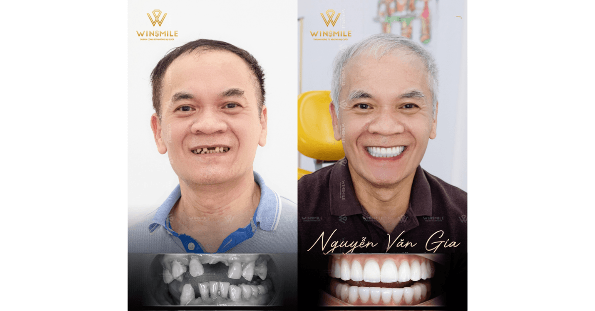 Win Smile Dental Clinic