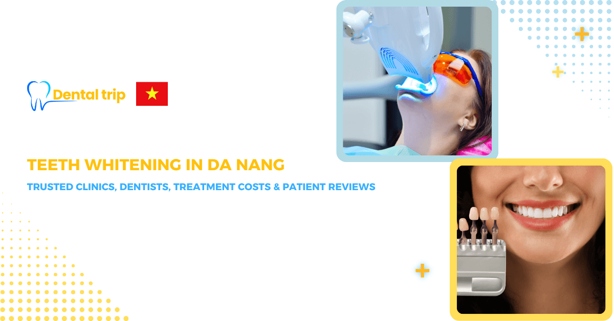 Trusted clinics for Teeth whitening in Da Nang