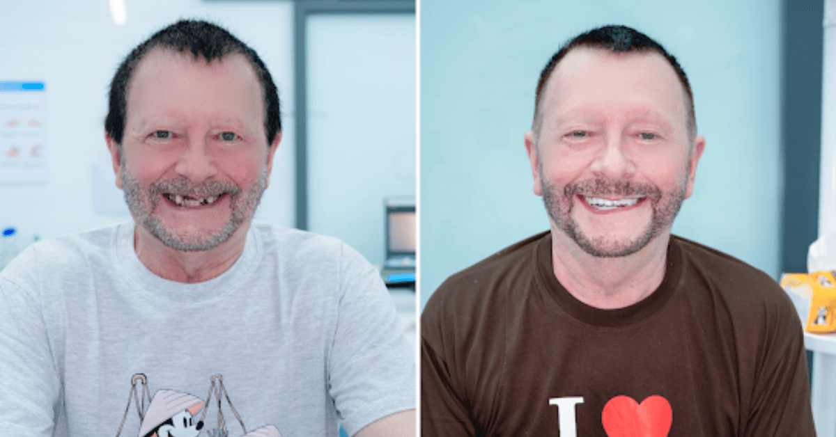 Restoring function and confidence with dental implants