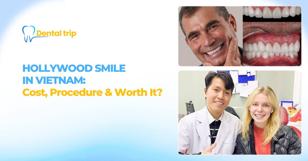 Hollywood Smile in Vietnam: Cost, Procedure & Is It Worth It for International Patients?