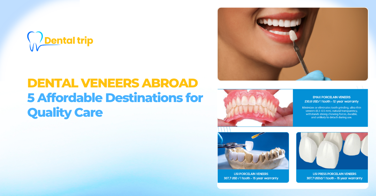 Dental veneers abroad