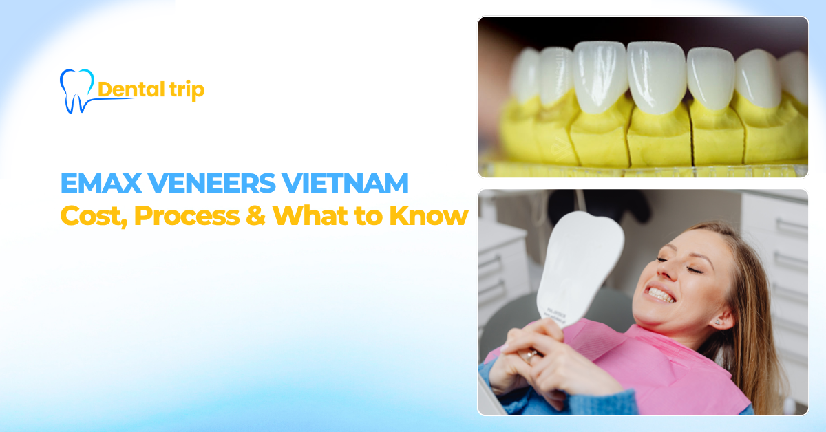 Emax Veneers in Vietnam