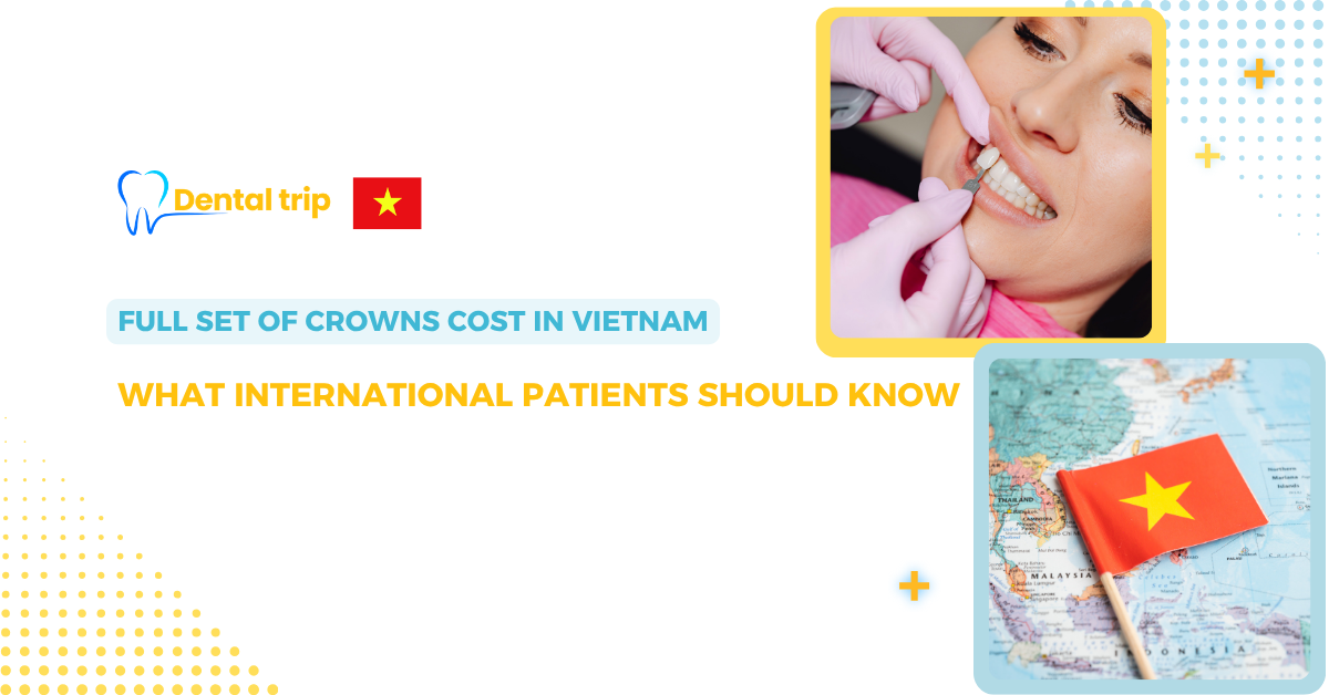 Full set of dental crowns cost in Vietnam
