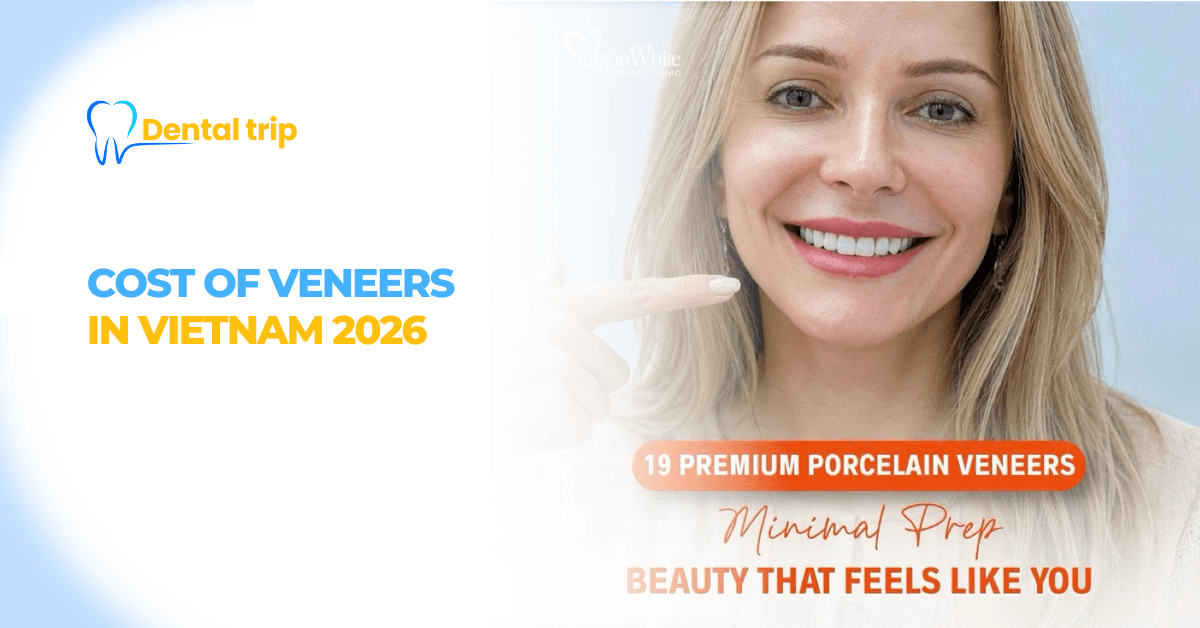 Veneers Cost in Vietnam